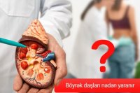 İnsana ən kəskin ağrını yaşadan böyrək daşları nədən yaranır?